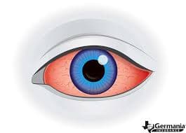 Eye Disorders